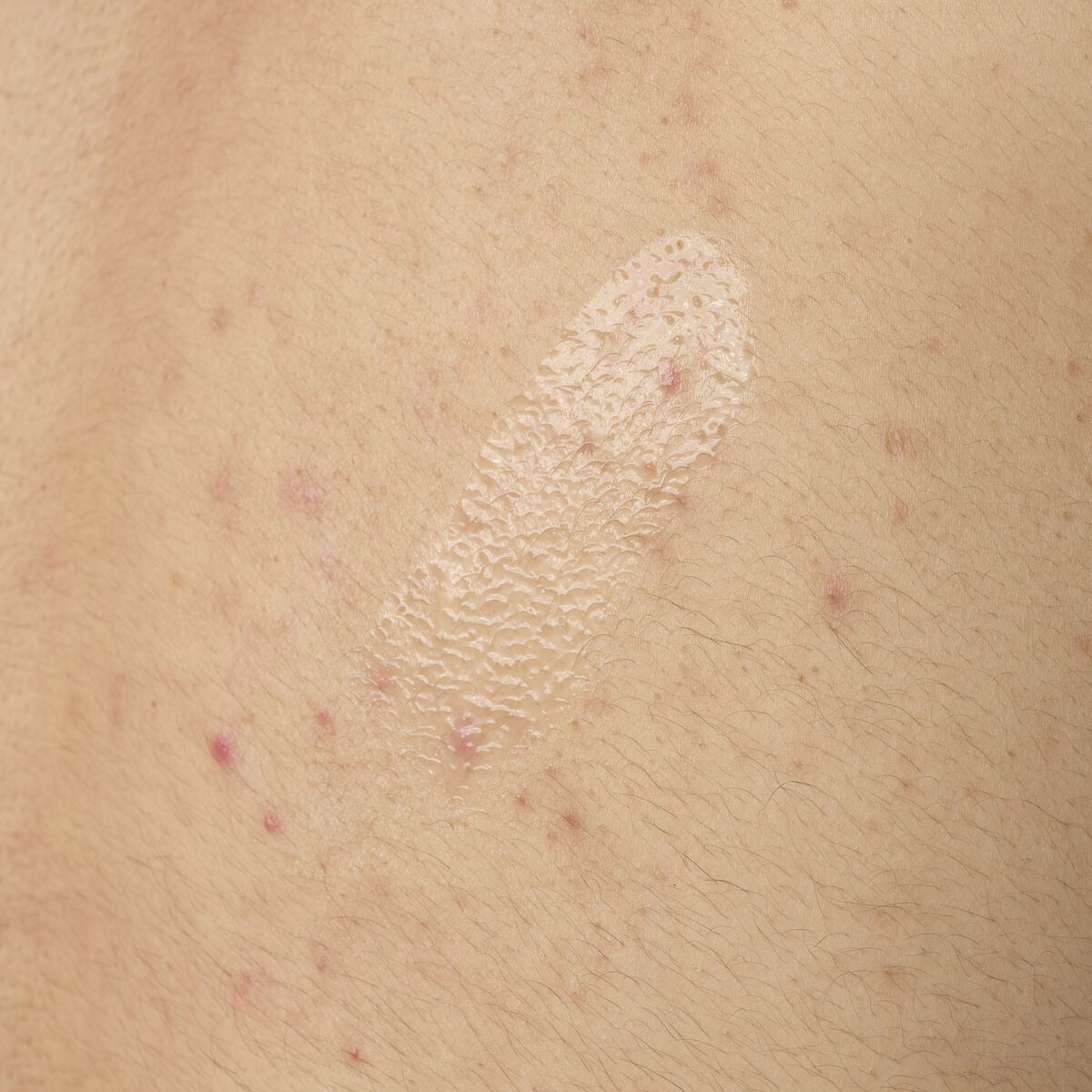 salicylic-acid-0-5-body-serum-f7 ORD-salicylic-acid-05-body-240ml-application.jpg