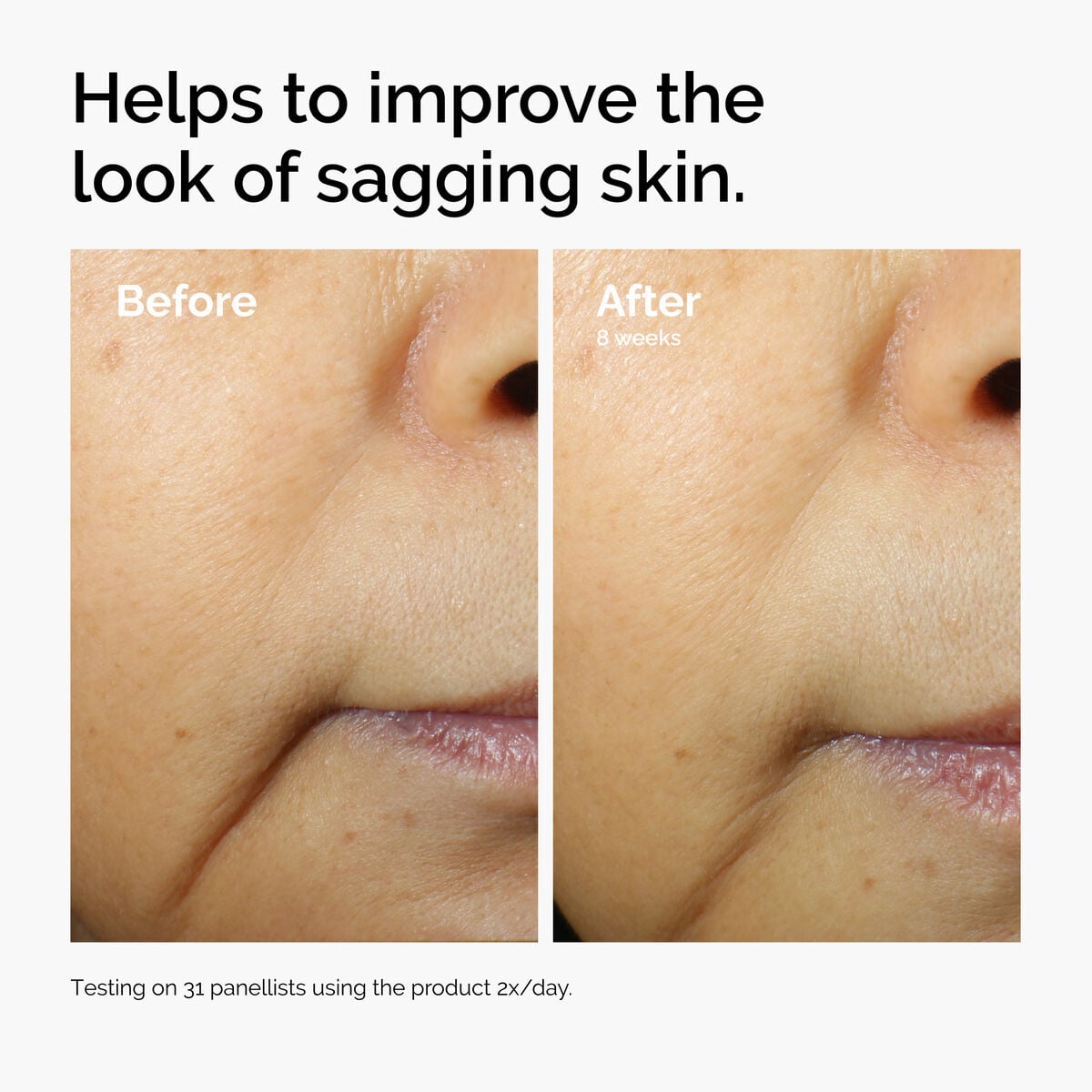 caffeine-3-escin-1-face-serum-i8 ord-caffeine-3pct-escin-1pct-face-serum-before-after-sagging.jpg