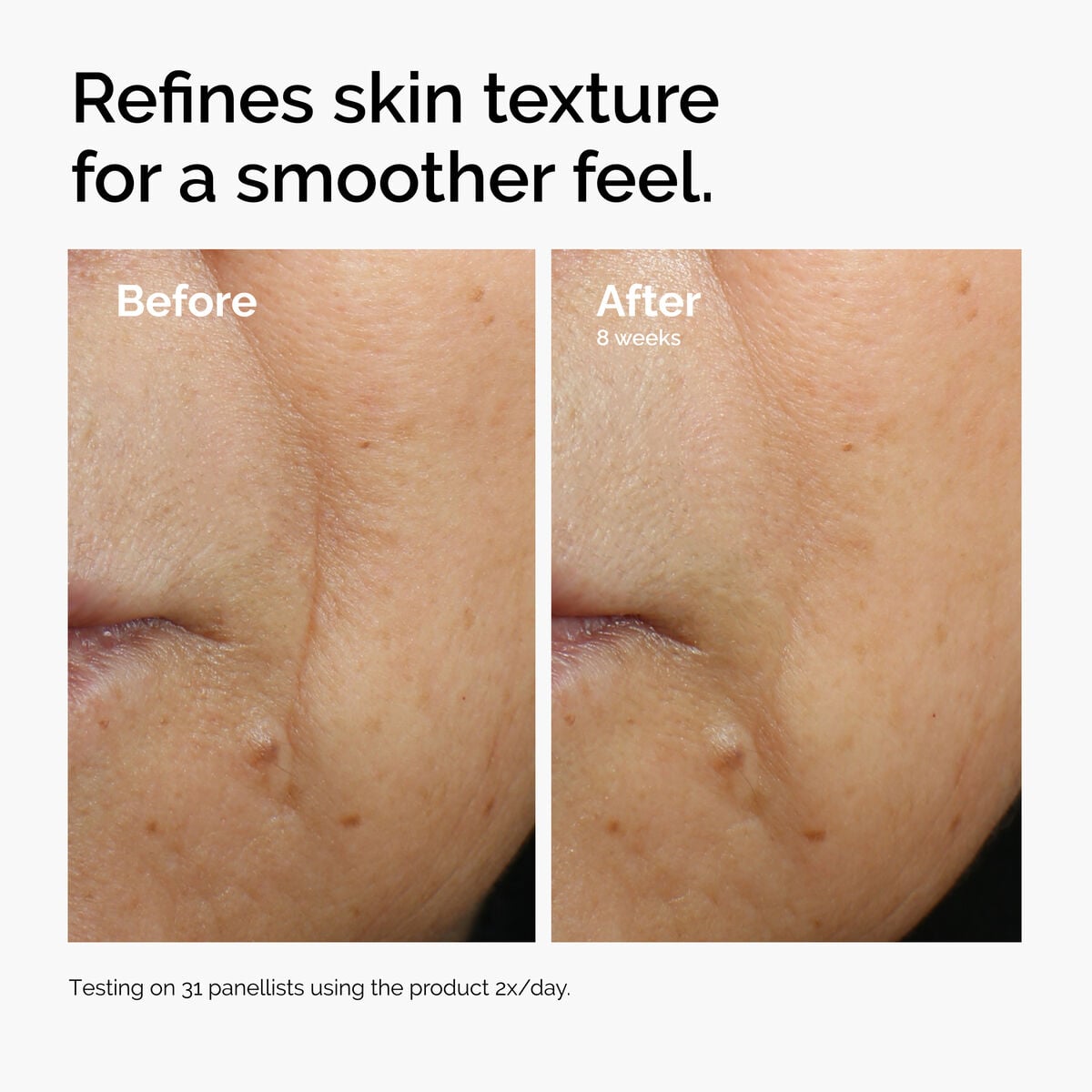 caffeine-3-escin-1-face-serum-i8 ord-caffeine-3pct-escin-1pct-face-serum-before-after-texture.jpg