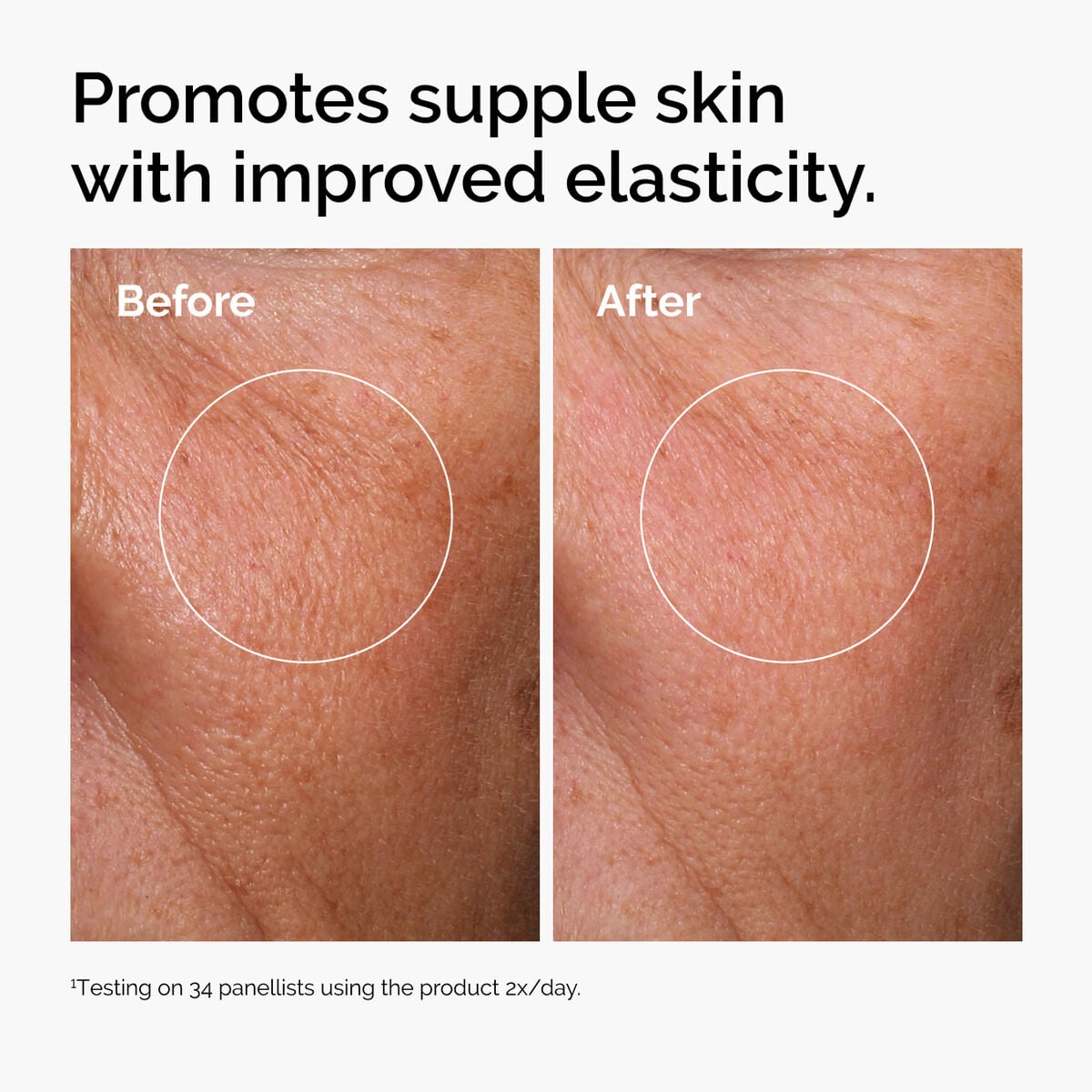hyaluronic-acid-2-b5-with-ceramides-e9 ord-hyaluronic-acid-2pct-b5-hydrating-serum-before-after-elasticity.jpg