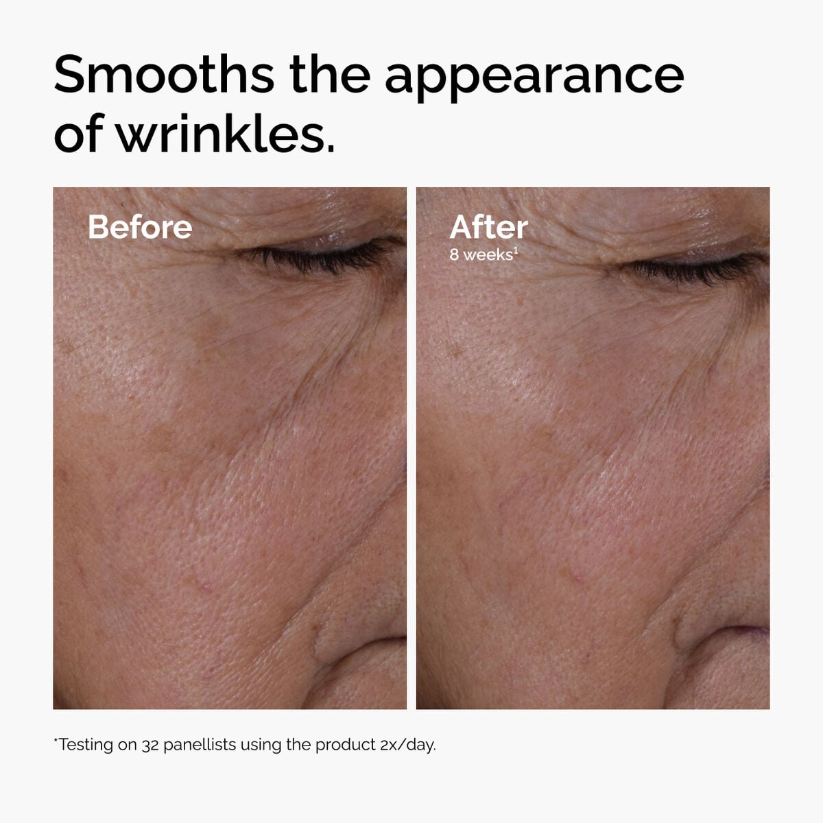 multi-peptide-ha-serum-y9 ord-multi-peptide-ha-serum-wrinkles-before-after.jpg
