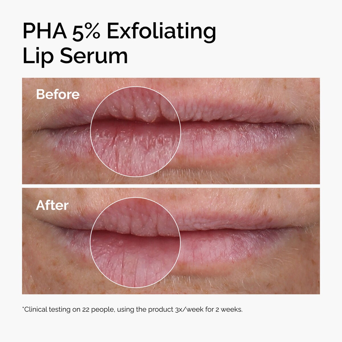 pha-5-exfoliating-lip-serum-s4 ord-pha-5pct-lip-exfoliating-serum-before-after.jpg